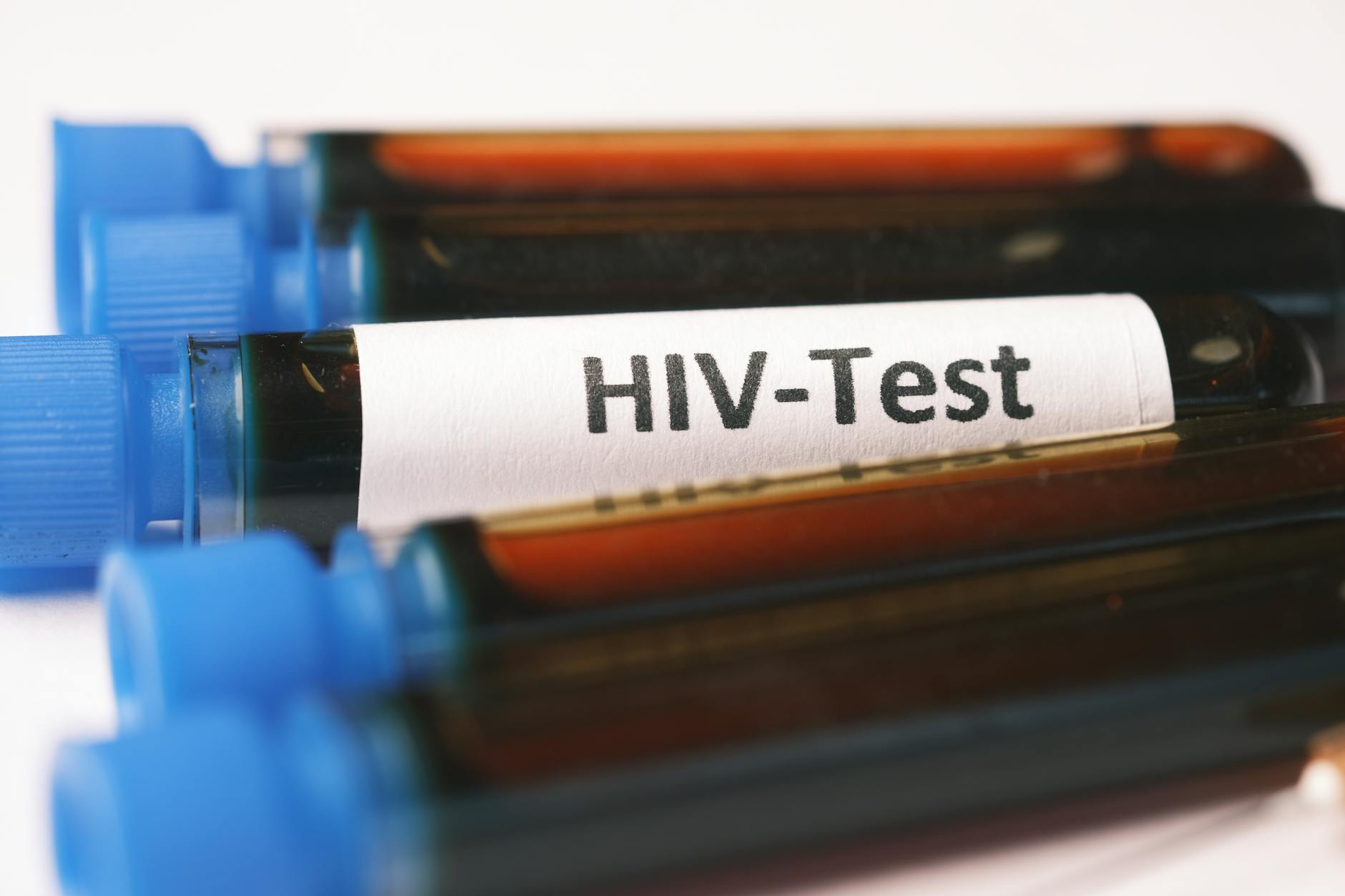 HIV Cases in Philippines are Rising at an Alarming Rate - The State Signal