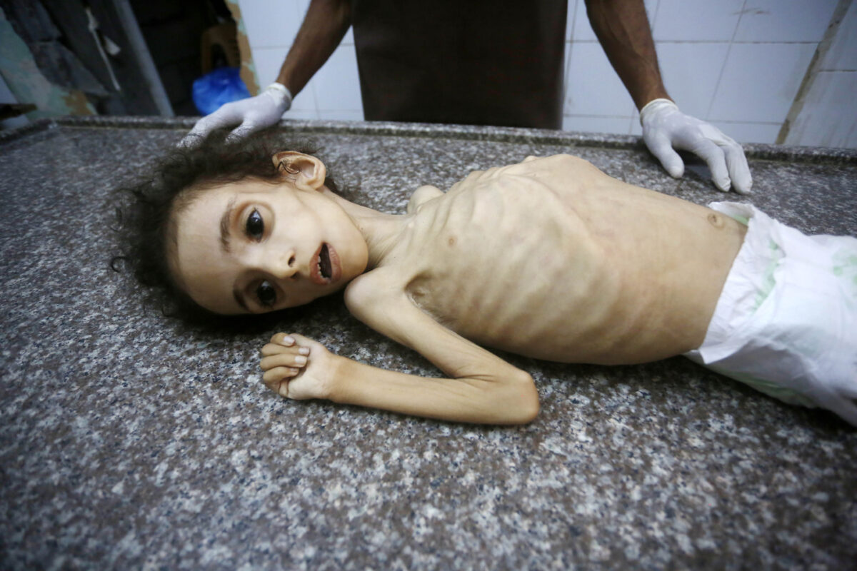 Israel is Using Starvation as a Weapon of War in Gaza; UNRWA - The State Signal Israel is Using Starvation as a Weapon of War in Gaza; UNRWA - The State Signal