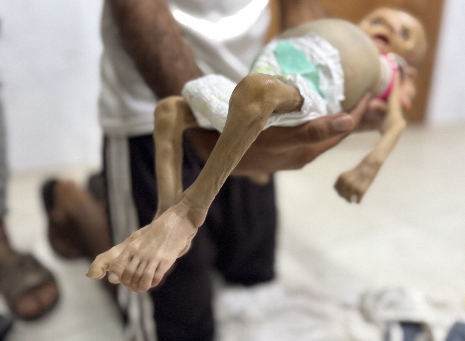 Famine in Gaza Strip Kills 5 - The State Signal