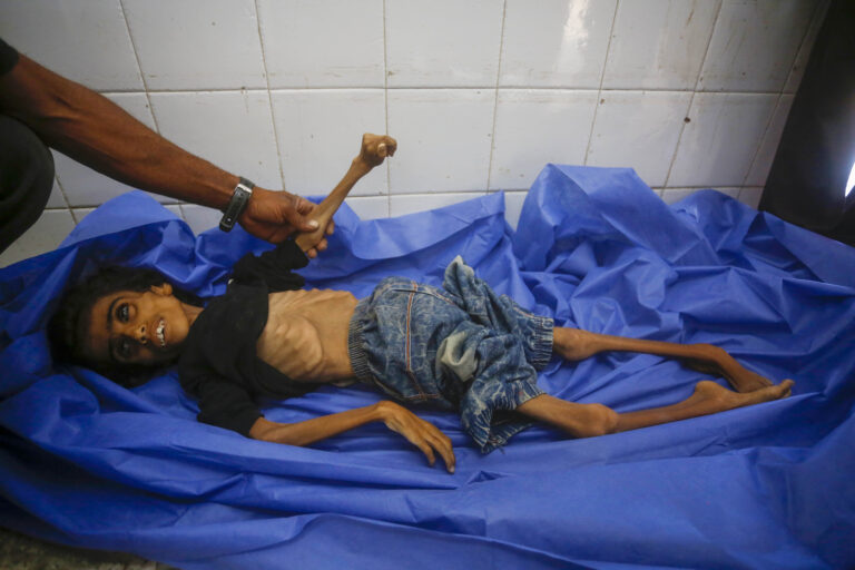 Mass Starvation in Gaza Kills 6 More - The State Signal