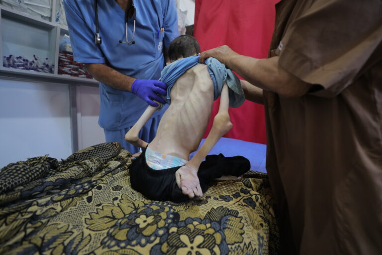 2 More Die of Starvation as Total Gaza Death Toll Tops 60,249 - The State Signal