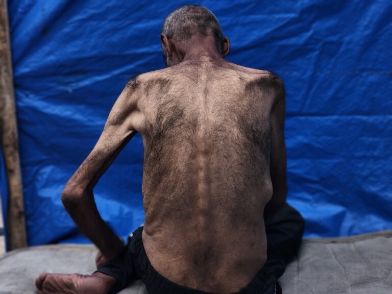 11 Gaza Starvation Deaths Reported in Last 24Hrs - The State Signal