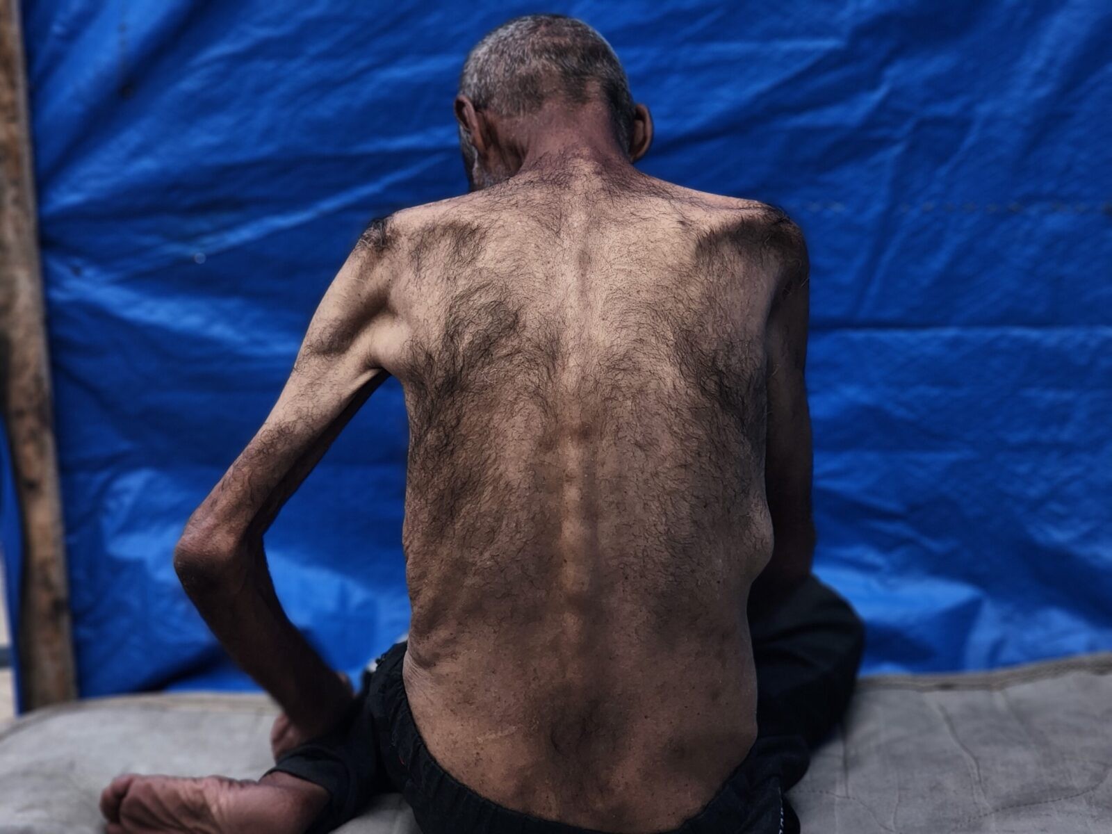 11 Gaza Starvation Deaths Reported in Last 24Hrs 11 Gaza Starvation Deaths Reported in Last 24Hrs - The State Signal