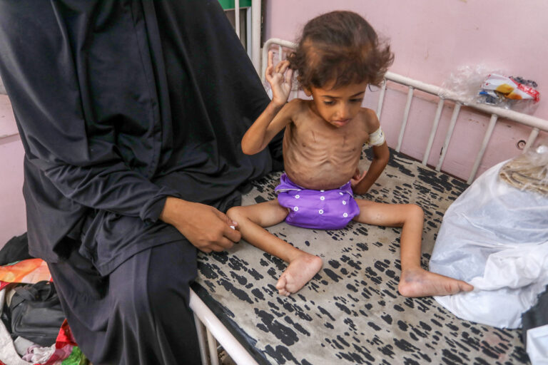 8 Die from Starvation as Gaza Death Toll Tops 62,622 - The State Signal