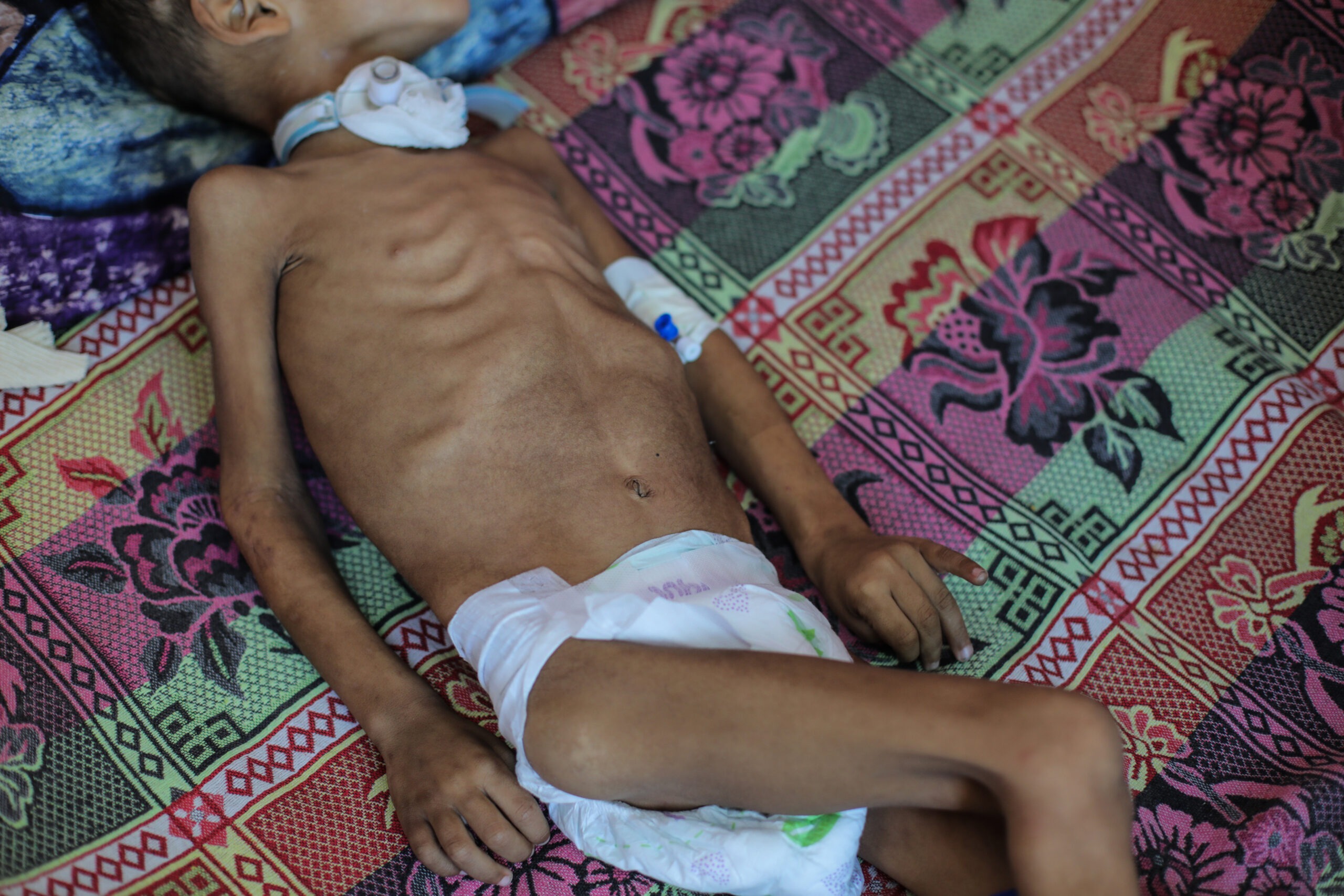 Gaza Famine Kills 4 as Israeli Attacks Kill 7 -The State Signal