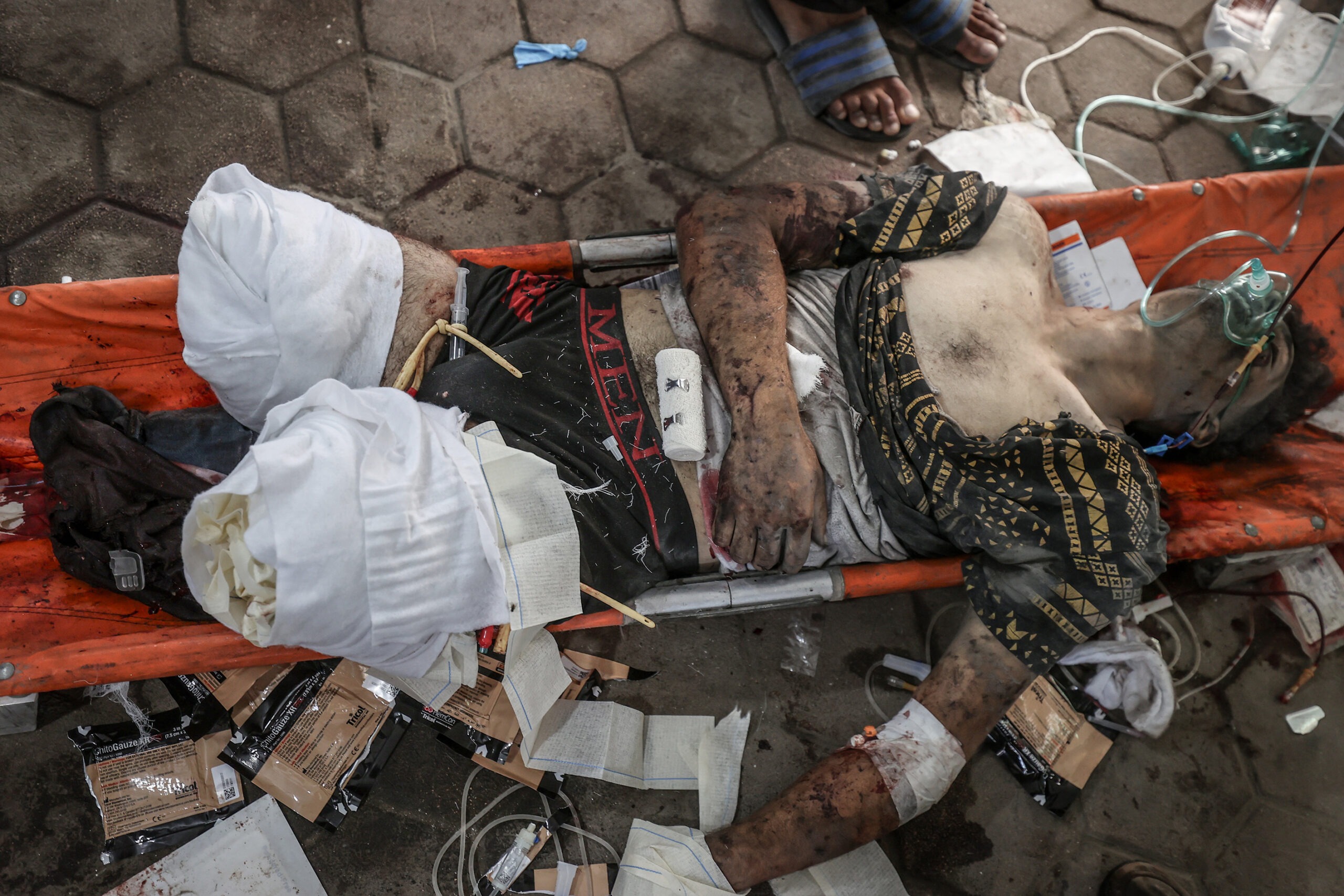 Israeli Settlers' Attacks Injure 20, as 18 are Killed by Israeli Airstrikes Across Gaza Strip - The State Signal