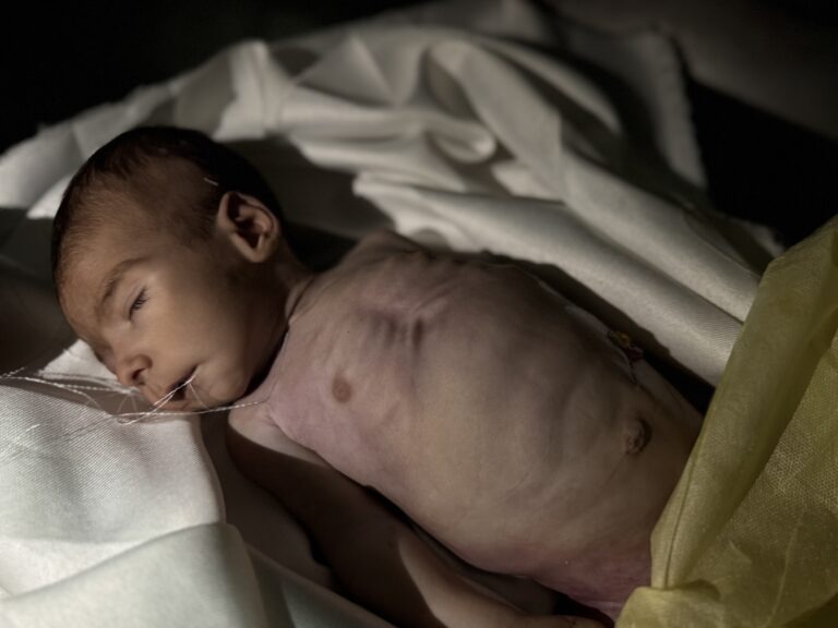 Gaza Famine Results to 5 More Deaths in Last 24 Hours - The State Signal