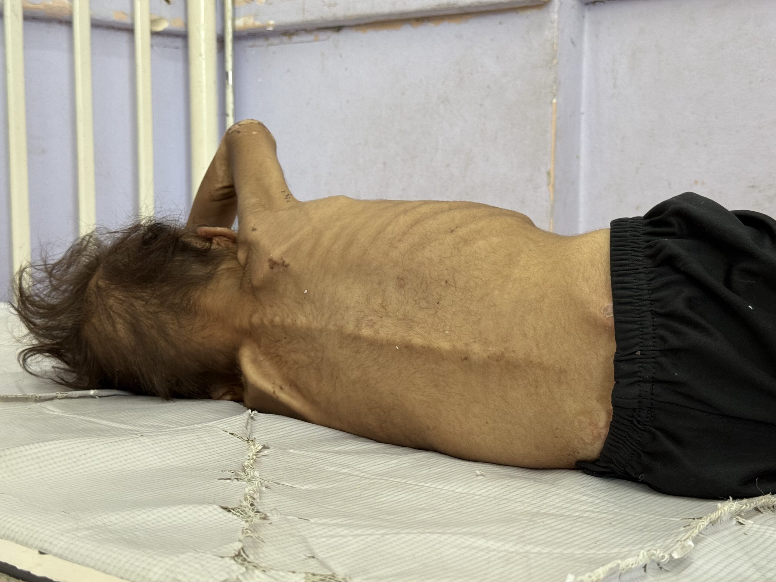 Gaza Starvation Kills Another 5 Palestinians, Death Toll at 404 - The State Signal