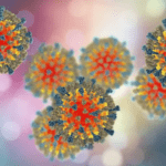 2026 Measles Cases in US Surge 2026 Measles Cases in US Surge - The State Signal