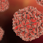 Polio Outbreak in Malawi Declared - The State Signal